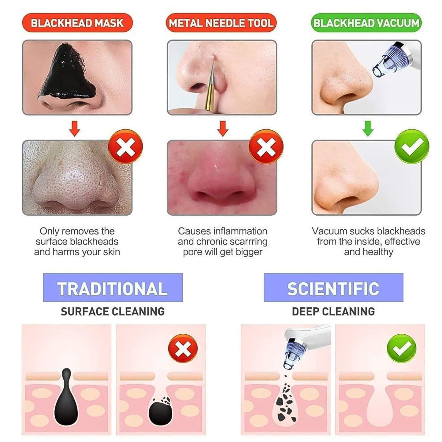 Vacuum Suction Tool With 4 Suction Head For Men And Women (Multi-color  1 Set) (Usb  Adapter Included)